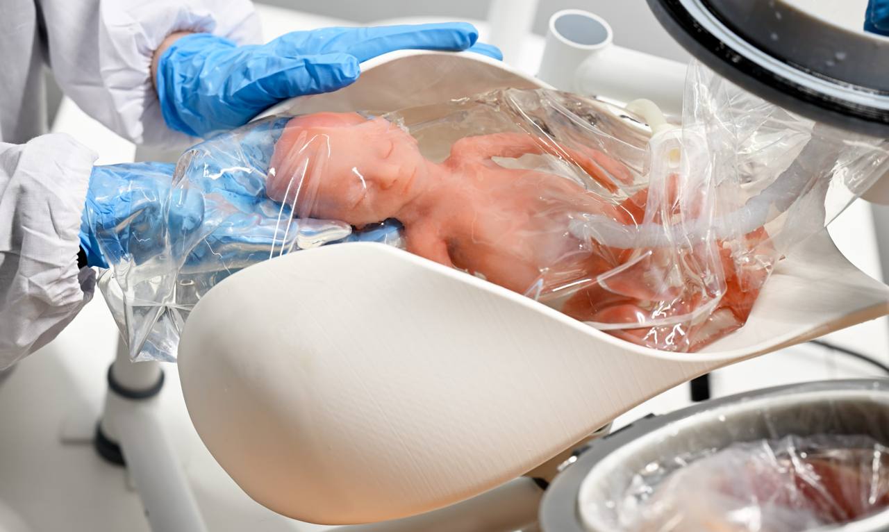 Útero artificial: La revolución médica que podría salvar a bebés prematuros